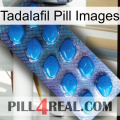 Tadalafil Pill Images viagra1